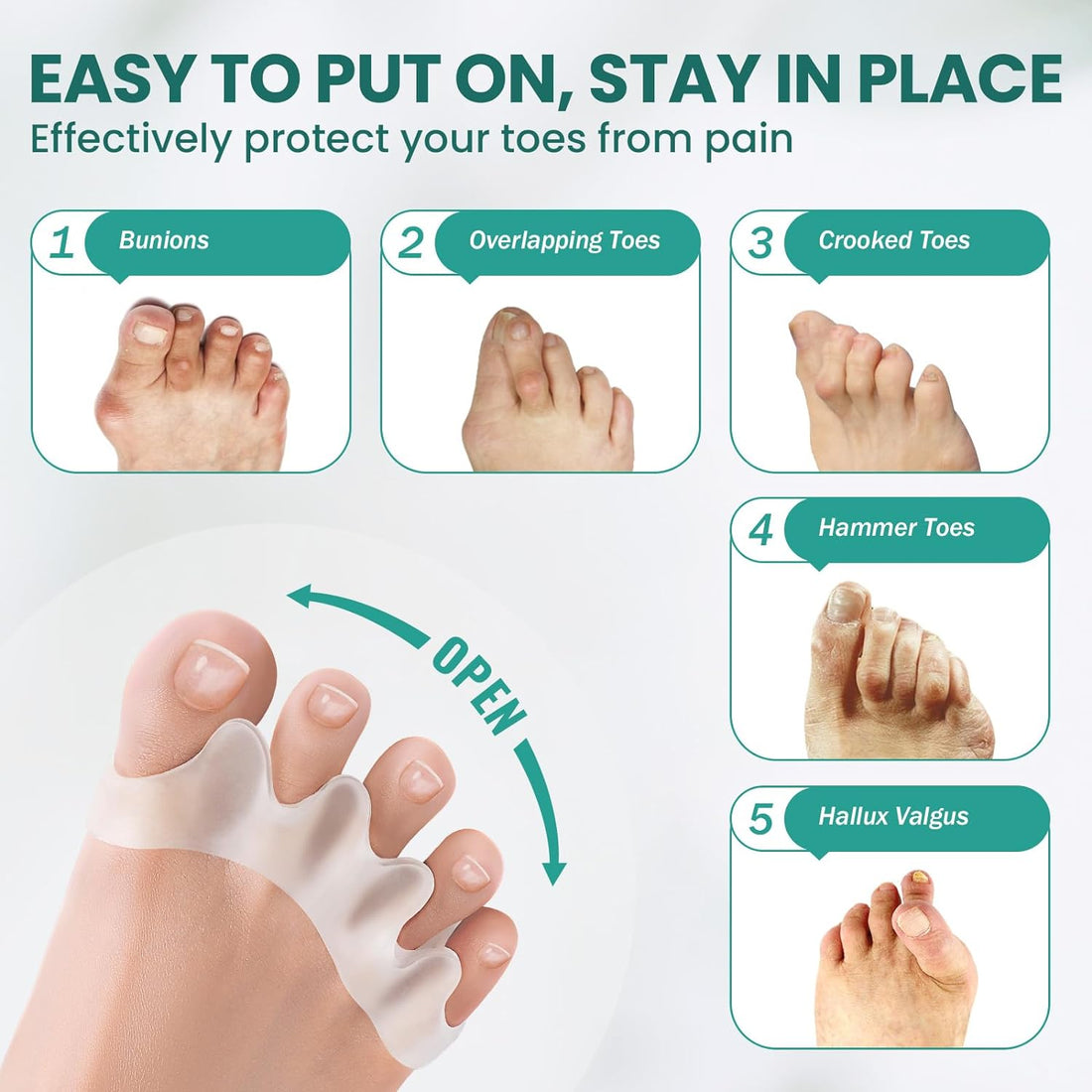 Toe Separators with Aloe Vera – 8 Pcs Foot & Toe Spacer | Soft Silicone Toe Corrector