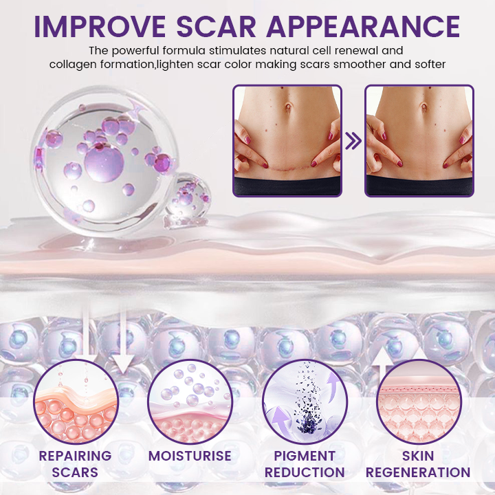 Timilk Regenscar Stem Cell Scar Gel 20g | Triple Action Scar Care Gel for Old & New Marks