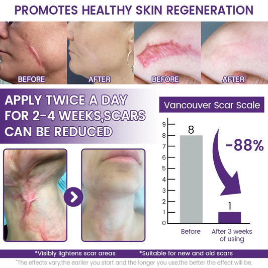 Timilk Regenscar Stem Cell Scar Gel 20g | Triple Action Scar Care Gel for Old & New Marks